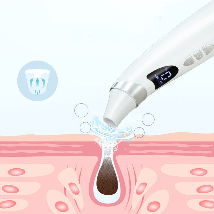 Electric Visual Blackhead Remover – Pore Cleaner with HD Camera & Strong Suction