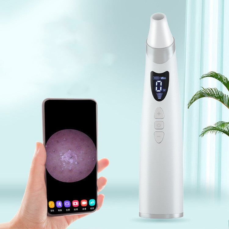 Electric Visual Blackhead Remover – Pore Cleaner with HD Camera & Strong Suction